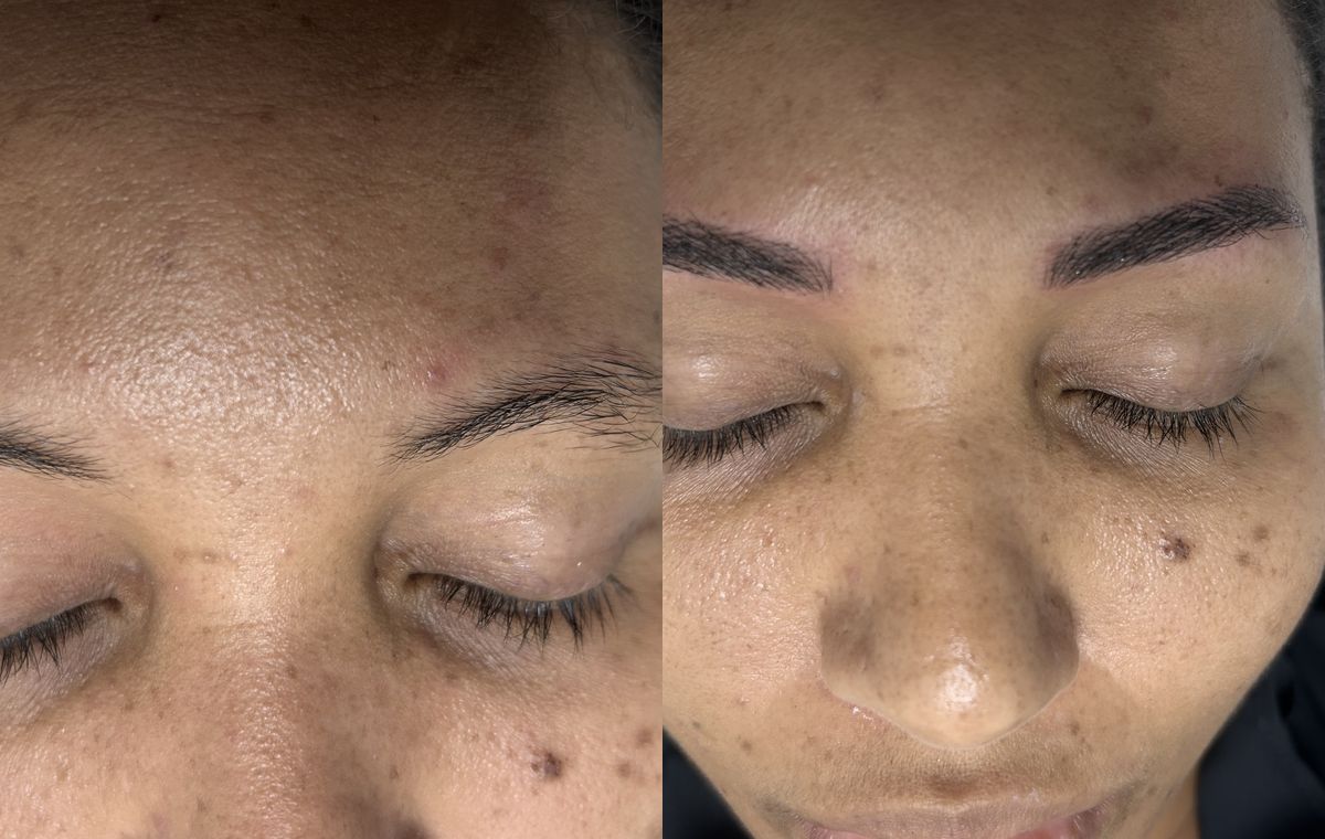 Before and after microblading: the same client before treatment on the left and after on the right